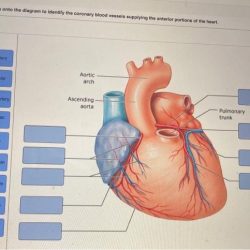 Drag the labels onto the diagram to identify the arteries